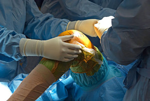 Операции на суставах и коленях в Израиле