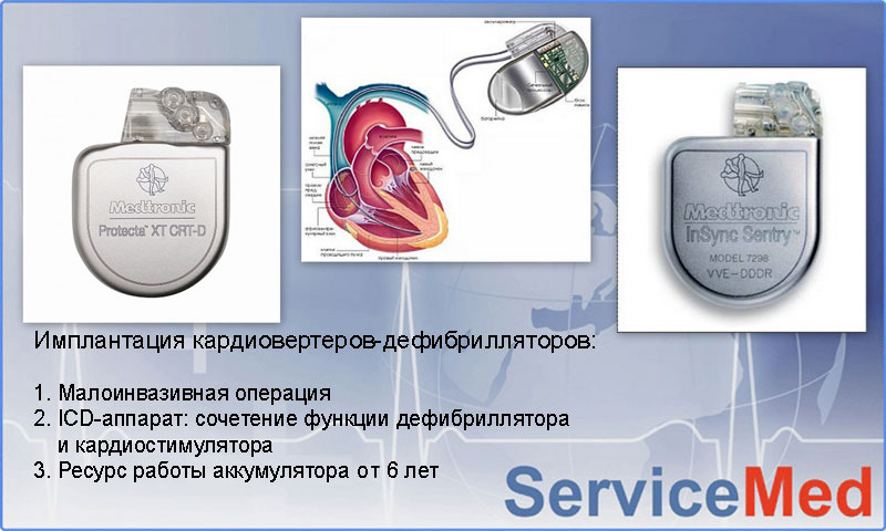 Имплантация кардиовертеров-дефибрилляторов в Израиле