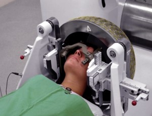 Лечение анапластической олигодендроглиомы головного мозга в Израиле